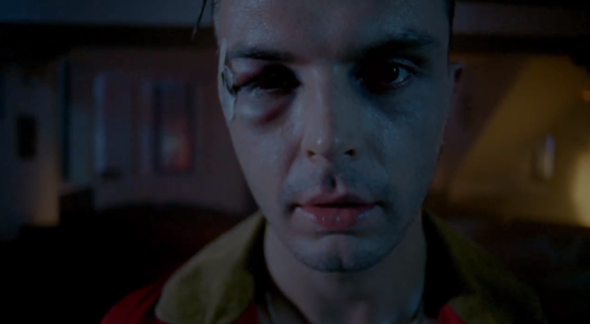 Love HURTS